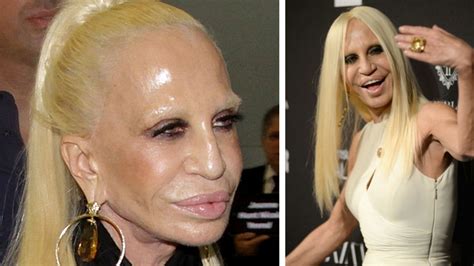 donatella versace operacje